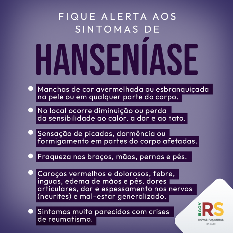 janeiron roxo3
