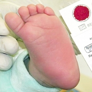 Imagem de um pé de bebê e de uma cartela com o sangue coletado ao lado.